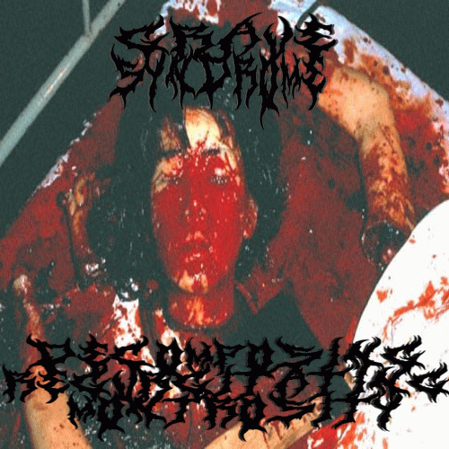 Grave Syndrome : Decomposing Regurgitating Monstrosity